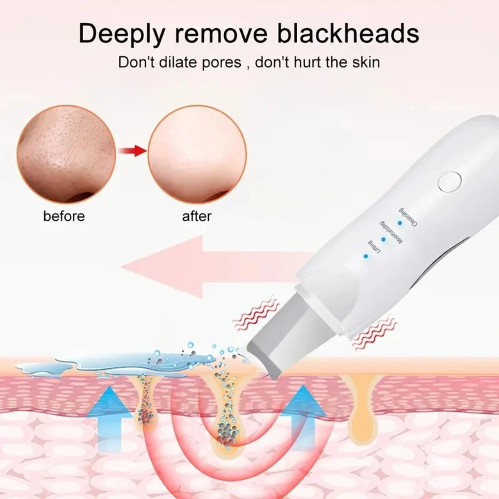 Ultrasonic Skin Scrubber – Deep Pore Cleanser & Blackhead Remover for Clear, Smooth Skin
