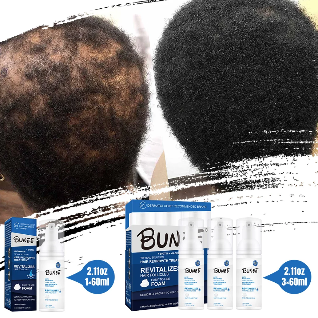3x60ml Regrow Hair & Fill Your Beard Naturally – See Visible Results in Just Weeks!
