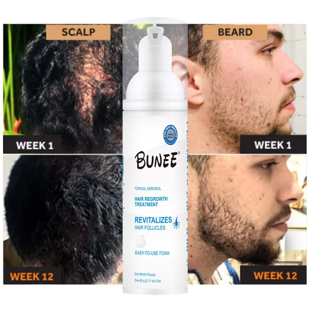 3x60ml Regrow Hair & Fill Your Beard Naturally – See Visible Results in Just Weeks!