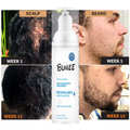 3x60ml Regrow Hair & Fill Your Beard Naturally – See Visible Results in Just Weeks!