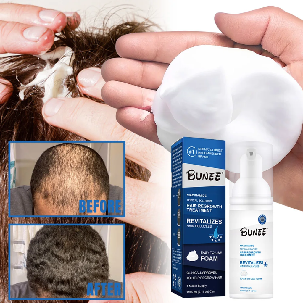 3x60ml Regrow Hair & Fill Your Beard Naturally – See Visible Results in Just Weeks!