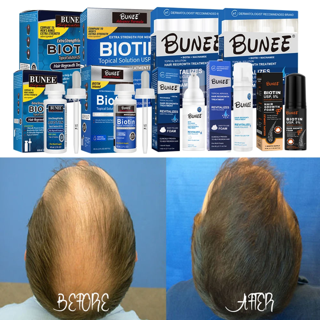 3x60ml Regrow Hair & Fill Your Beard Naturally – See Visible Results in Just Weeks!
