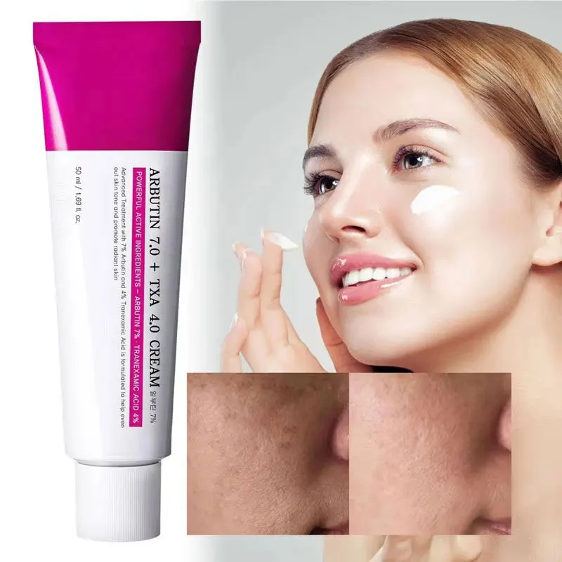 Tube of Arbutin 7.0 + TXA 40 Cream with a woman applying it to her face.