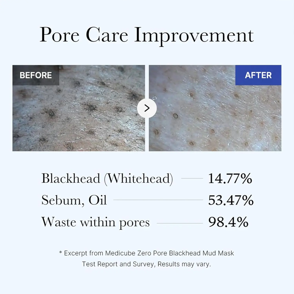 Before and after comparison of pore care improvement with text on blackheads, sebum, and waste within pores.