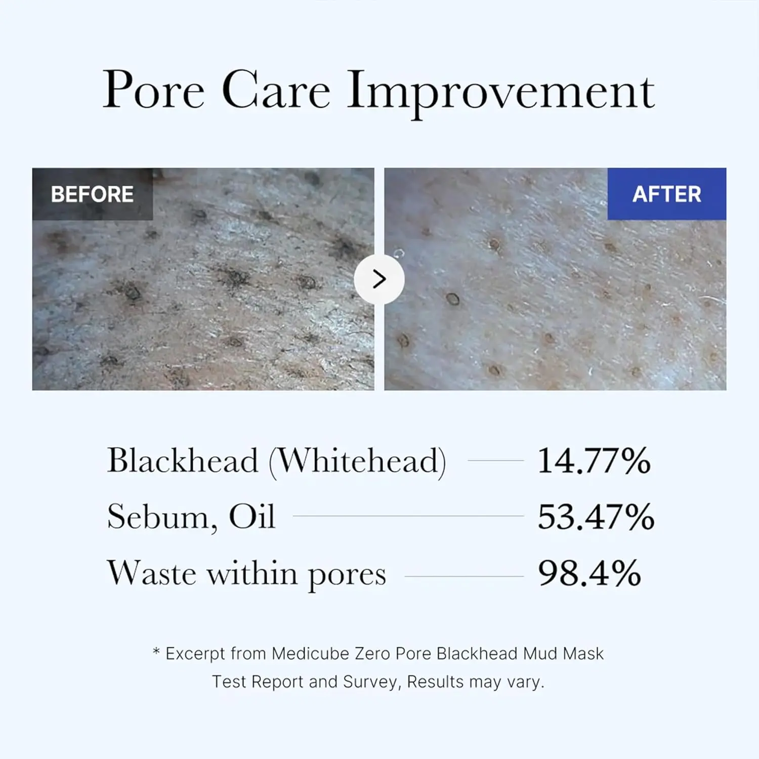 Before and after comparison of pore care improvement with text on blackheads, sebum, and waste within pores.