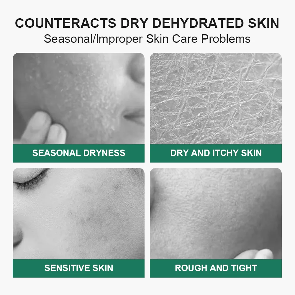 A marketing graphic with the headline 'COUNTERACTS DRY DEHYDRATED SKIN' and subtext 'Seasonal/Improper Skin Care Problems.' Below are four square panels showing close-up skin textures and facial areas labeled 'SEASONAL DRYNESS,' 'DRY AND ITCHY SKIN,' 'SENSITIVE SKIN,' and 'ROUGH AND TIGHT.