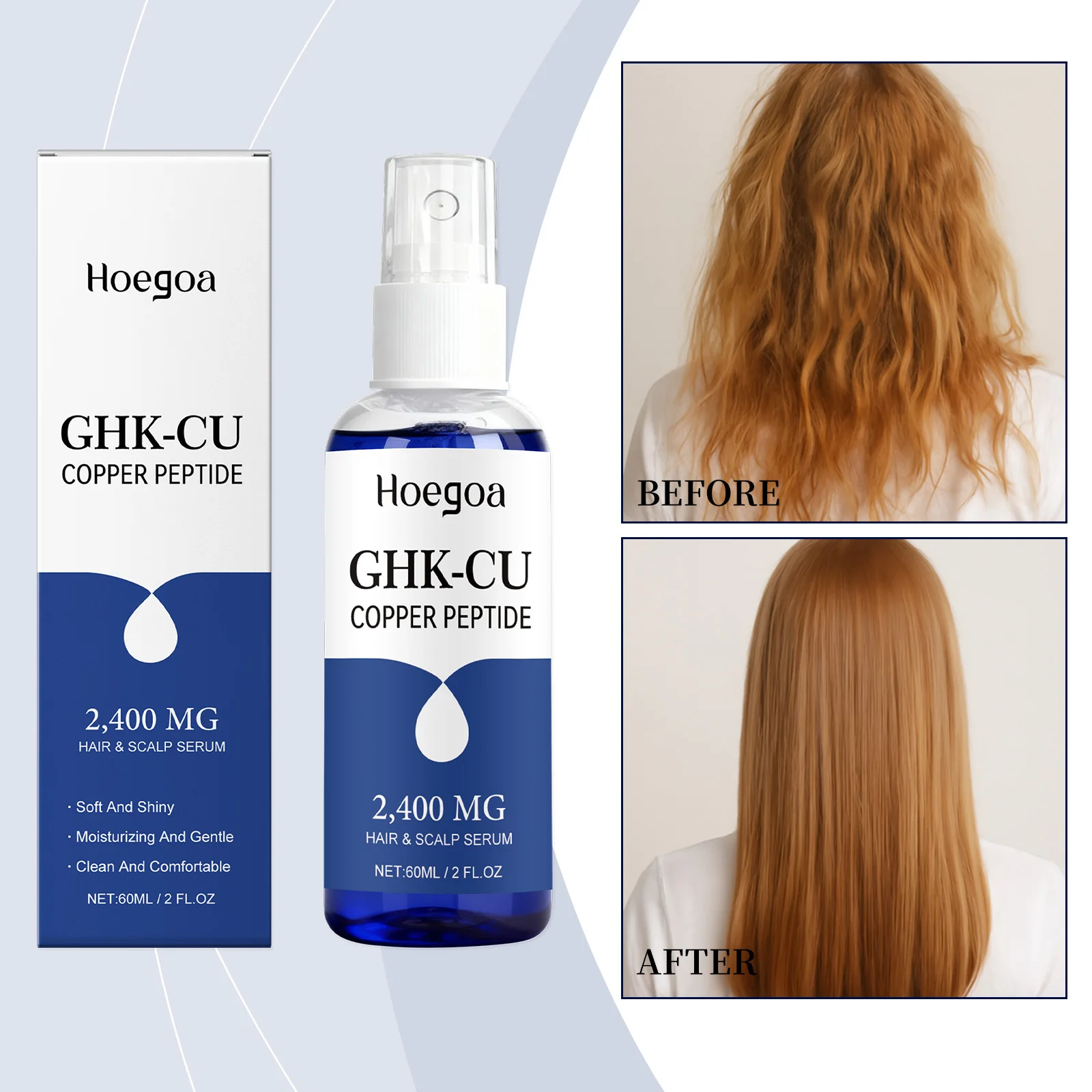 Hoegoa GHK-CU Copper Peptide Hair & Scalp Serum shown with its retail box and spray bottle, alongside before-and-after hair growth results on a model with long auburn hair.