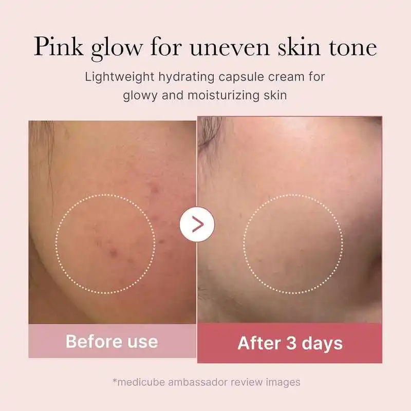 Before and after comparison of skin with a pink glow for uneven skin tone, showing hydration cream effects.