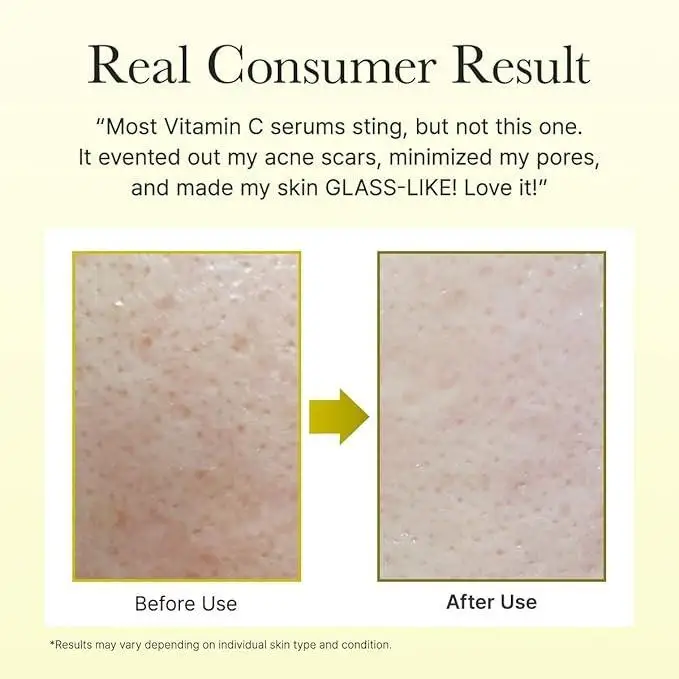 A before-and-after skin comparison graphic with the headline 'Real Consumer Result' and a testimonial quote above. The left panel labeled 'Before Use' shows textured skin, and the right panel labeled 'After Use' shows smoother, clearer skin, separated by a yellow arrow on a pale cream background.