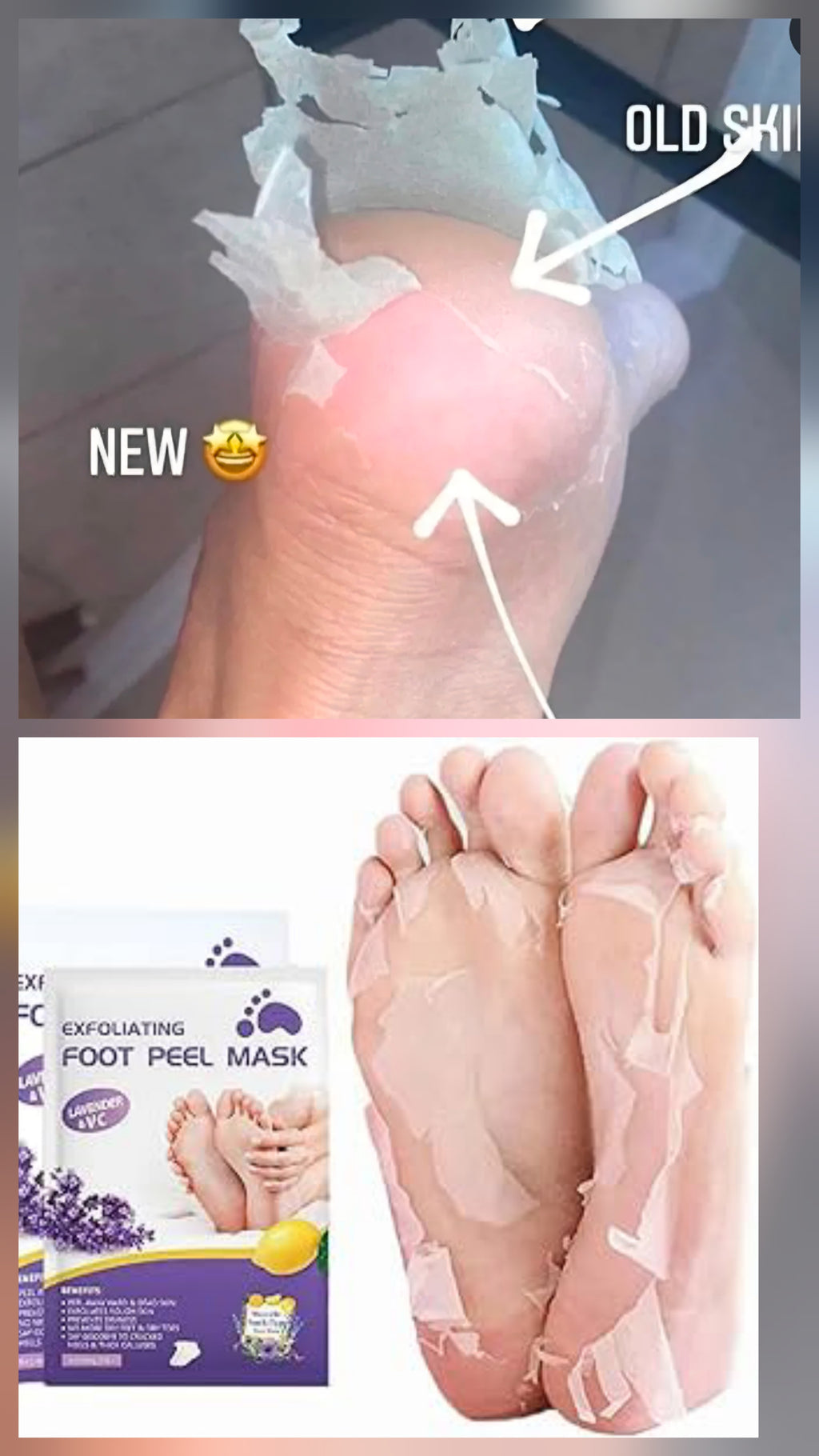 Lavender & Vitamin C Foot Peel Mask (1 Pair) – Deep Exfoliation for Baby‑Soft, Smooth Feet