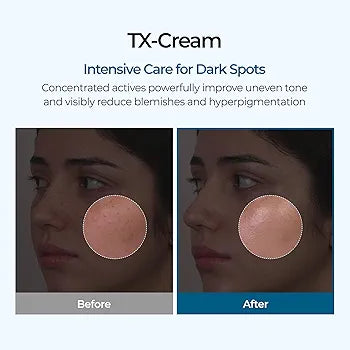 TX-Cream advertisement showing before and after effects on skin with dark spots.