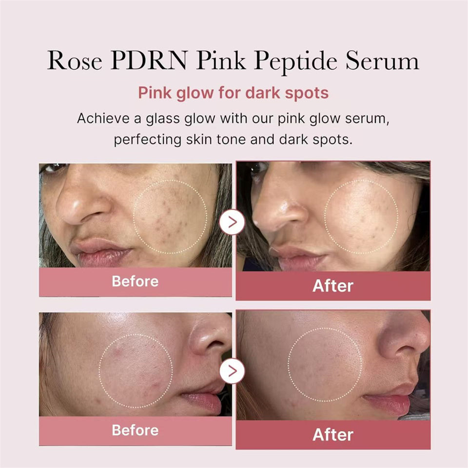 Medicube PDRN Pink Drops – Korean Glass Skin Glow Serum
