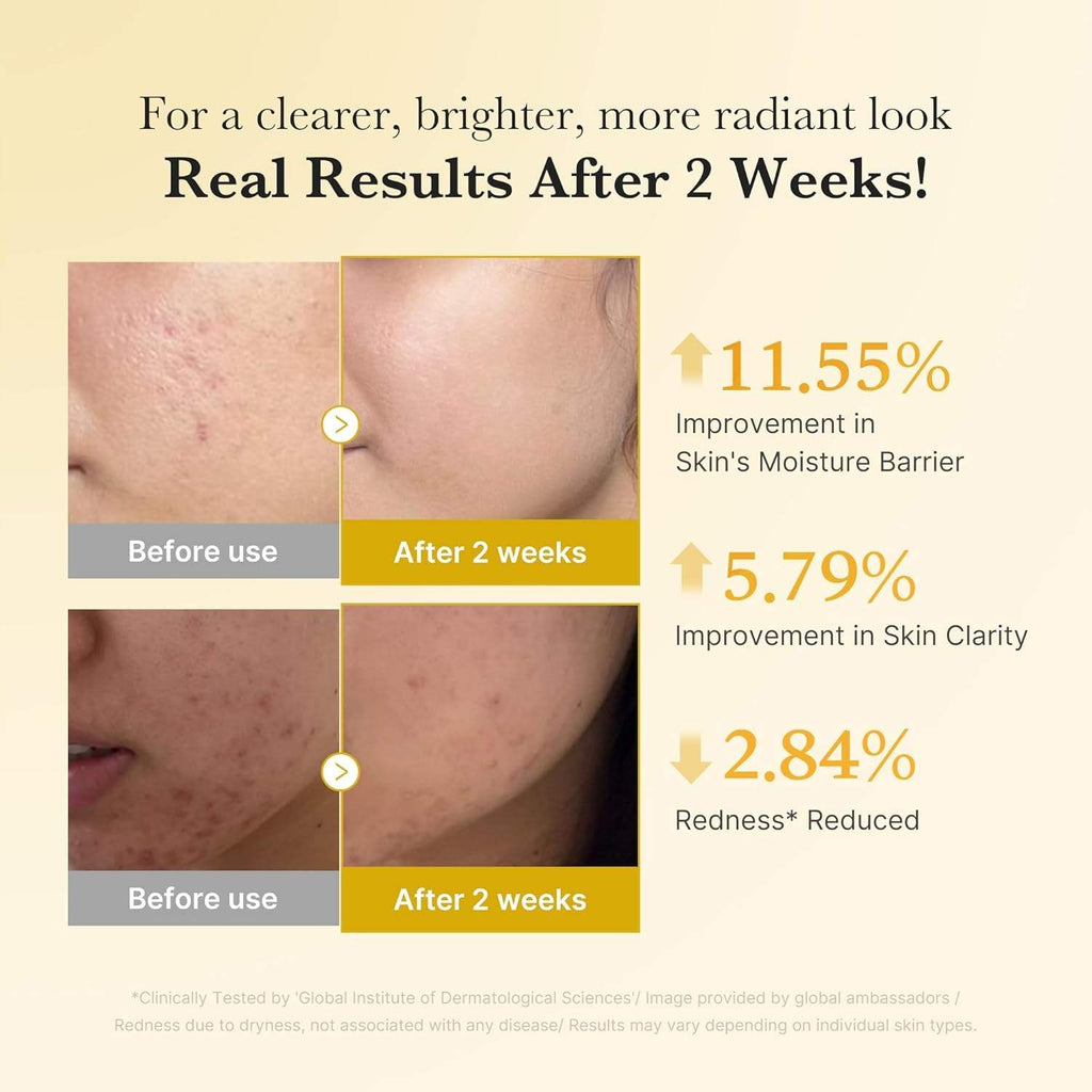 Medicube Kojic Glow Serum for Radiant Glass Skin