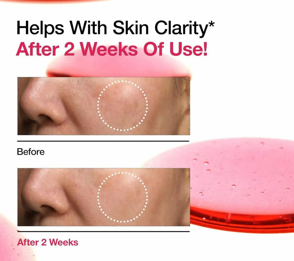 ANUA 10+ Dark Spot Correcting Glow Serum – Brighten, Fade & Glow Fast