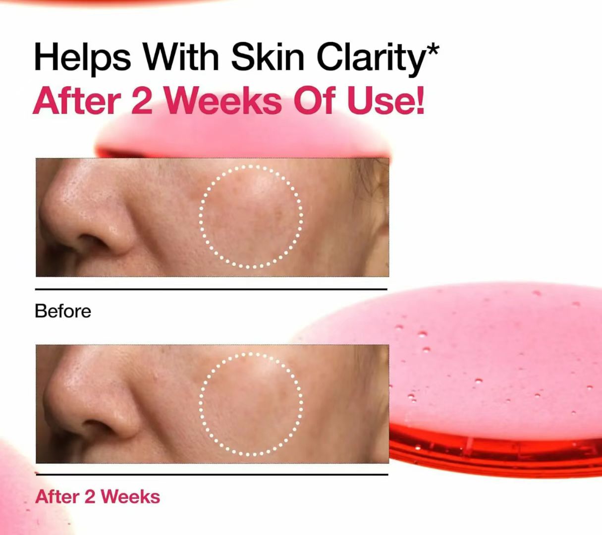 ANUA 10+ Dark Spot Correcting Glow Serum – Brighten, Fade & Glow Fast