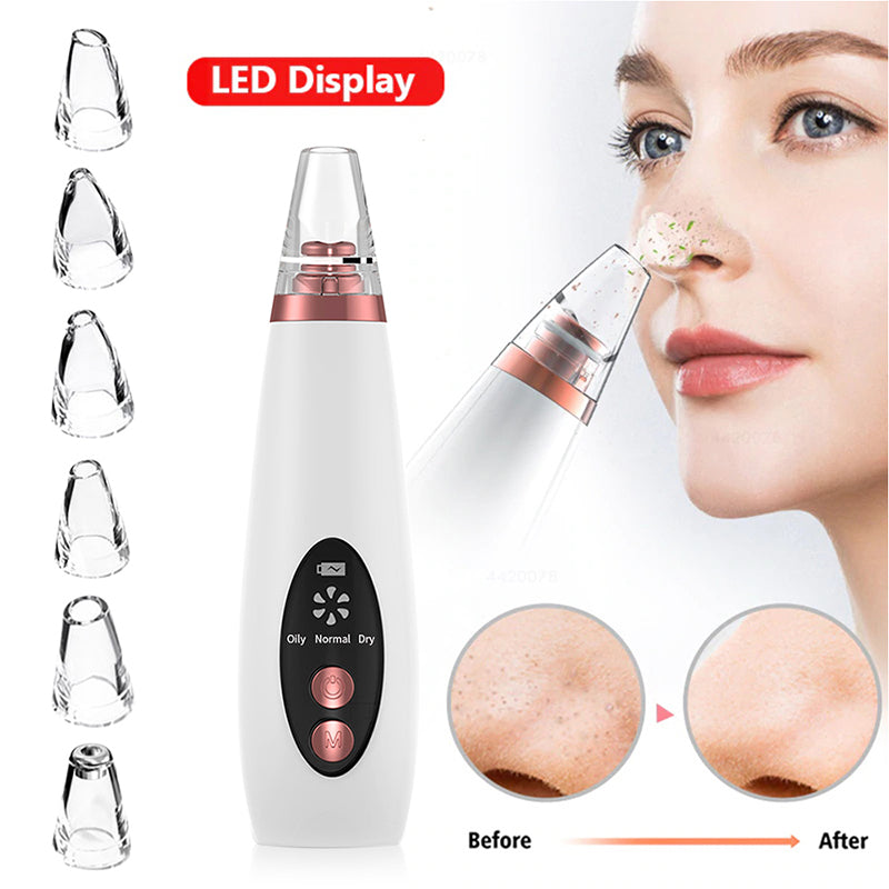 Pro Blackhead Remover Vacuum – Deep Pore Cleaner & Acne Extraction Tool for Clear, Smooth Skin